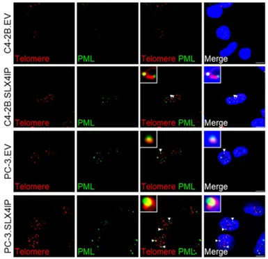 Figure from: SLX4IP Promotes Telomere Maintenance in Androgen Receptor–Independent Castration-Resistant Prostate Cancer through ALT-like Telomeric PML Localization